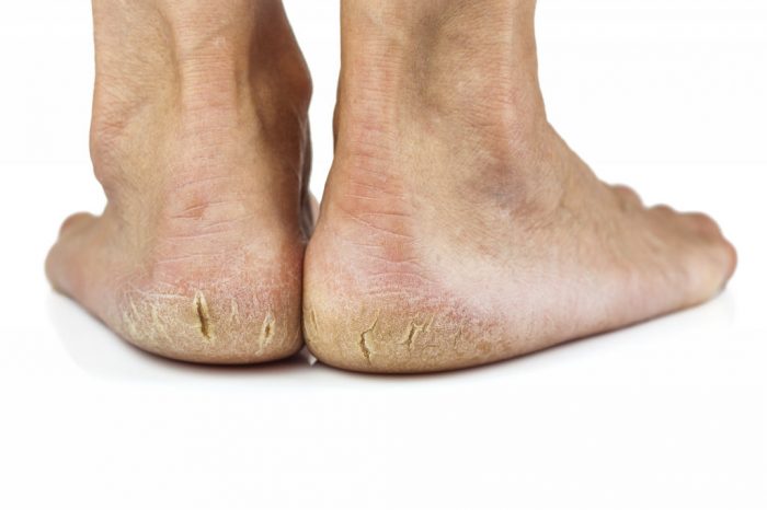 pieds secs 