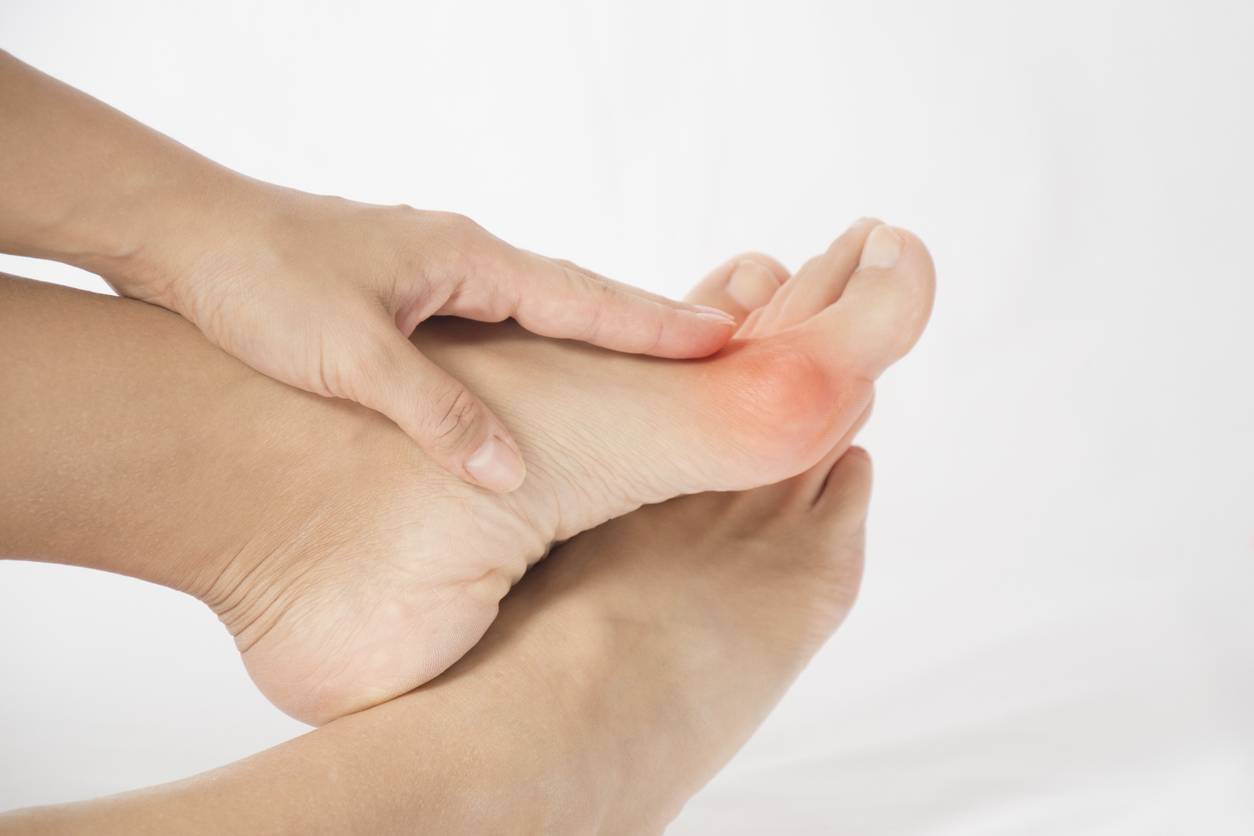soigner hallux valgus